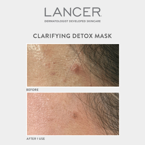 Lancer-Clarifying Detox Mask