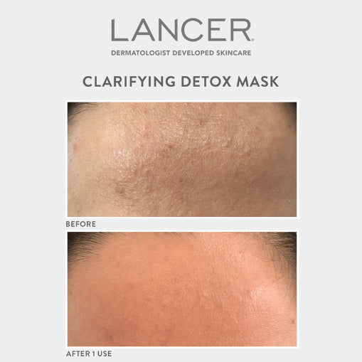 Lancer-Clarifying Detox Mask