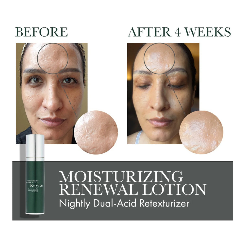 MOISTURIZING RENEWAL LOTION